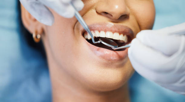 Best Emergency Dental Care for Sports Injuries in Rainbow Springs, FL